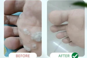 Transformation 1 (1) Transformation 1 (1)
